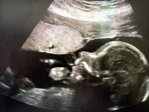 bebe-5mois